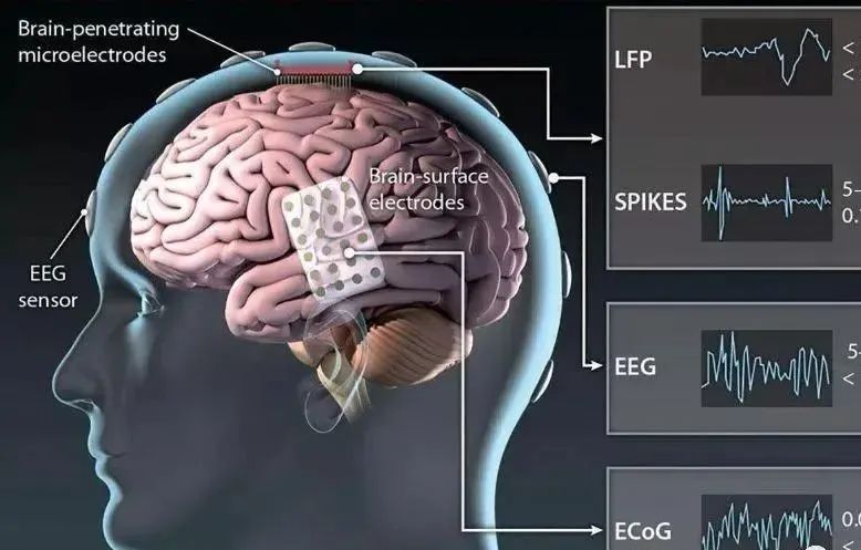 赛微电子：在脑机接口技术体系中，MEMS生物芯片技术已得到应用